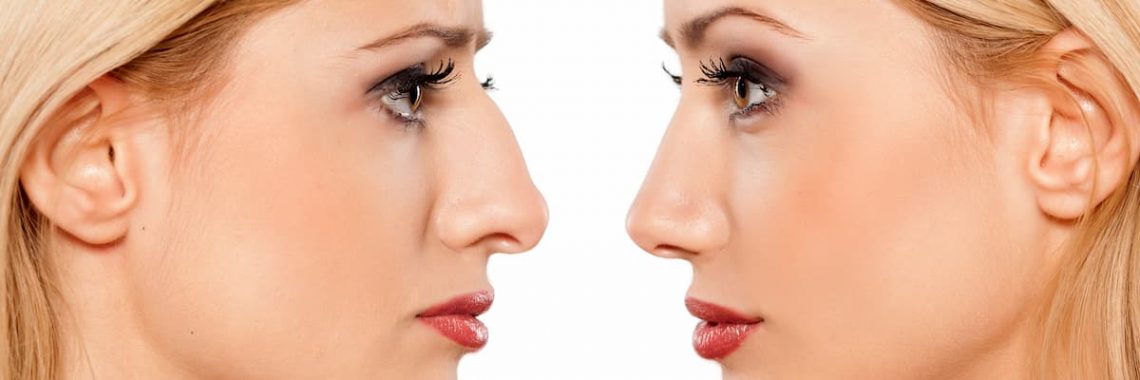 Injectable Dermal Fillers